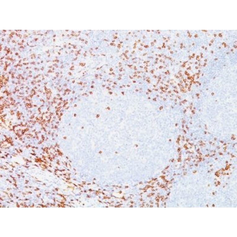 Immunohistochemistry (formalin-fixed, paraffin-embedded) - Anti-CD8 alpha Antibody [C8/468] (Biotin) (A352564) - Antibodies.com