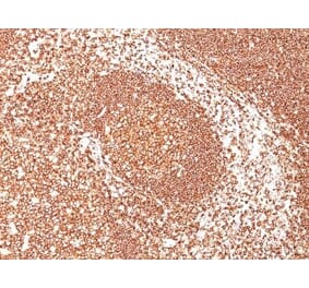 Immunohistochemistry (formalin-fixed, paraffin-embedded) - Anti-CD45 Antibody [2B11] (CF®660R) (A352568) - Antibodies.com