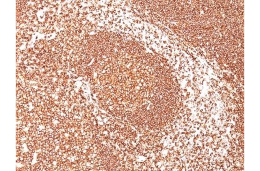 Immunohistochemistry (formalin-fixed, paraffin-embedded) - Anti-CD45 Antibody [2B11] (CF®660R) (A352568) - Antibodies.com