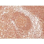 Immunohistochemistry (formalin-fixed, paraffin-embedded) - Anti-CD45 Antibody [2B11] (CF®660R) (A352568) - Antibodies.com