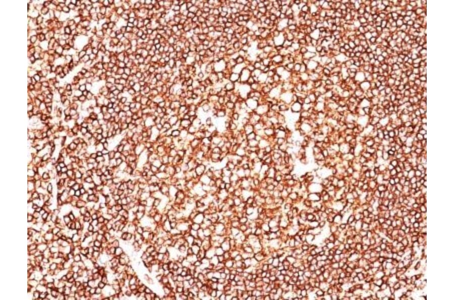 Immunohistochemistry (formalin-fixed, paraffin-embedded) - Anti-CD45 Antibody [2B11] (CF®660R) (A352568) - Antibodies.com