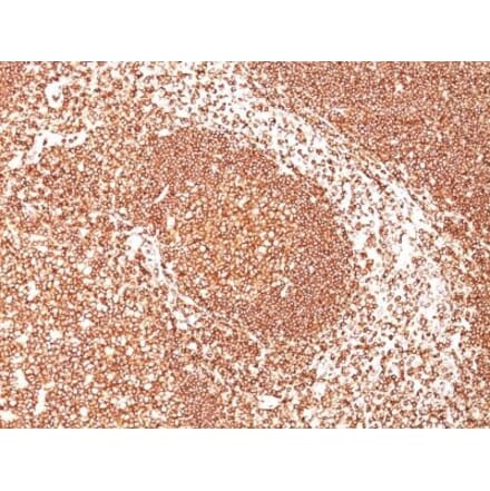 Immunohistochemistry (formalin-fixed, paraffin-embedded) - Anti-CD45 Antibody [2B11] (CF®740) (A352571) - Antibodies.com