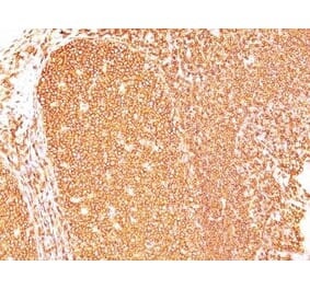 Immunohistochemistry (formalin-fixed, paraffin-embedded) - Anti-CD45RB Antibody [PD7/26] (CF®640R) (A352576) - Antibodies.com