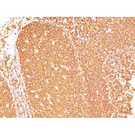 Immunohistochemistry (formalin-fixed, paraffin-embedded) - Anti-CD45RB Antibody [PD7/26] (CF®647) (A352577) - Antibodies.com