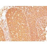 Immunohistochemistry (formalin-fixed, paraffin-embedded) - Anti-CD45RB Antibody [PD7/26] (CF®740) (A352579) - Antibodies.com