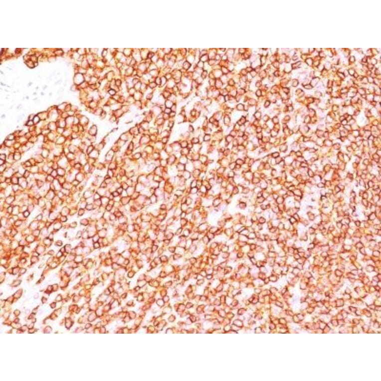Immunohistochemistry (formalin-fixed, paraffin-embedded) - Anti-CD45RB Antibody [PD7/26] (CF®740) (A352579) - Antibodies.com