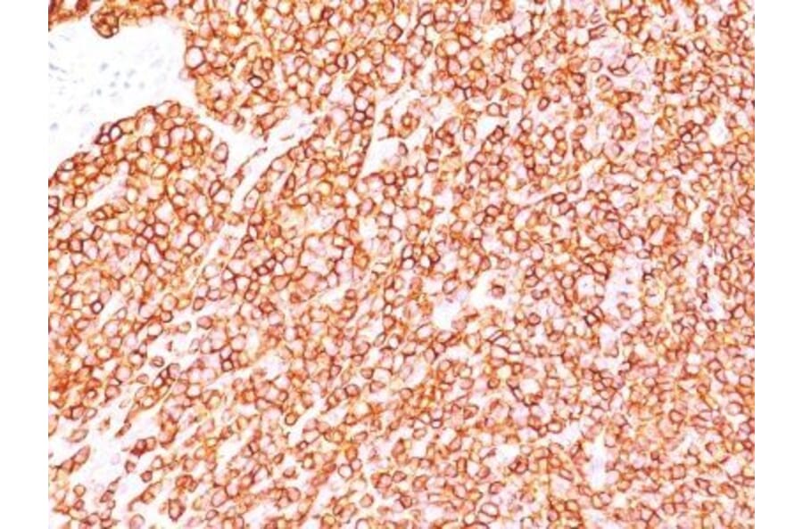 Immunohistochemistry (formalin-fixed, paraffin-embedded) - Anti-CD45RB Antibody [PD7/26] (CF®488A) (A352580) - Antibodies.com