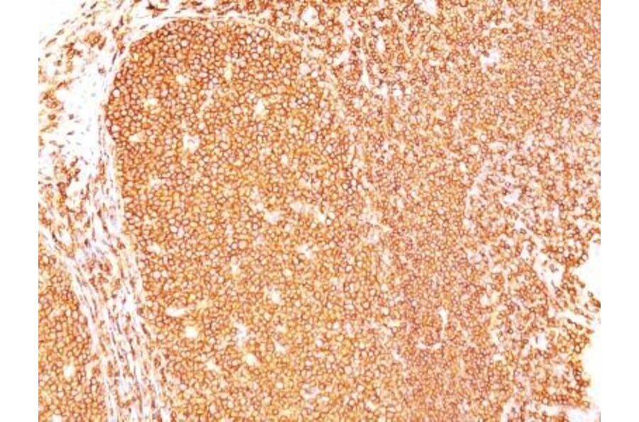 Immunohistochemistry (formalin-fixed, paraffin-embedded) - Anti-CD45RB Antibody [PD7/26] (Biotin) (A352582) - Antibodies.com