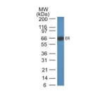 Wstern Blot - Anti-Estrogen Receptor alpha Antibody [ER505] (CF®405S) (A352583) - Antibodies.com