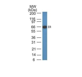 Wstern Blot - Anti-Estrogen Receptor alpha Antibody [ER505] (CF®640R) (A352584) - Antibodies.com