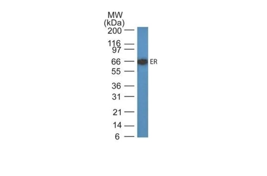 Wstern Blot - Anti-Estrogen Receptor alpha Antibody [ER505] (CF®640R) (A352584) - Antibodies.com