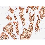 Immunohistochemistry (formalin-fixed, paraffin-embedded) - Anti-Estrogen Receptor alpha Antibody [ER505] (CF®647) (A352585) - Antibodies.com