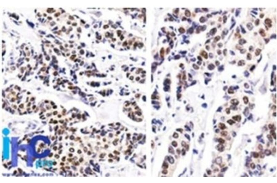 Immunohistochemistry (formalin-fixed, paraffin-embedded) - Anti-Estrogen Receptor alpha Antibody [ER506] (CF®405M) (A352592) - Antibodies.com