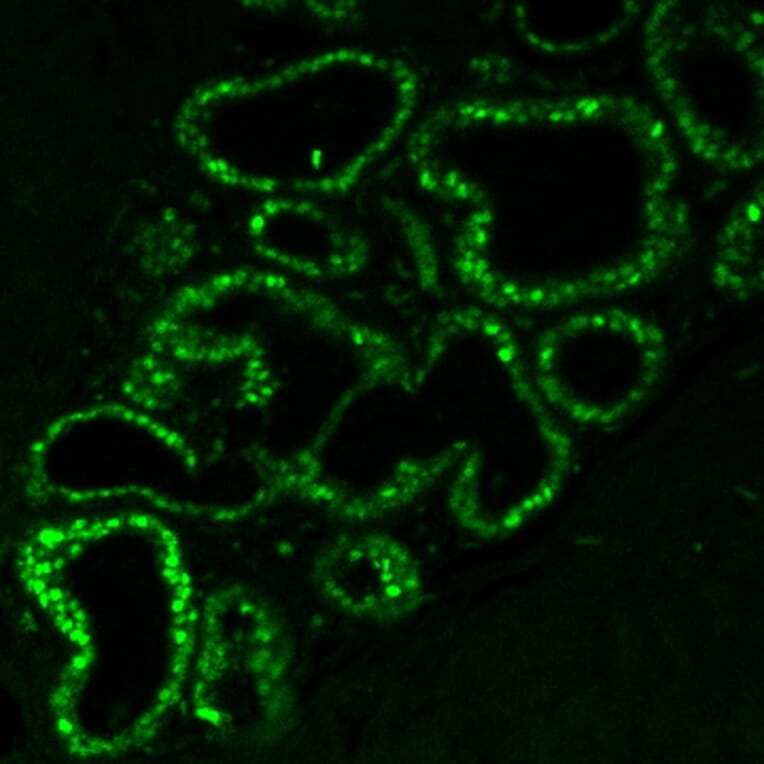 Immunofluorescence - Anti-Estrogen Receptor alpha Antibody [ER506] (CF®647) (A352594) - Antibodies.com
