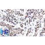 Immunohistochemistry (formalin-fixed, paraffin-embedded) - Anti-Estrogen Receptor alpha Antibody [ER506] (CF®647) (A352594) - Antibodies.com
