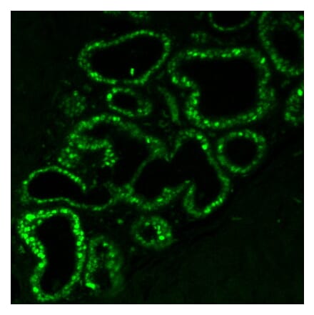 Immunofluorescence - Anti-Estrogen Receptor alpha Antibody [ER506] (CF®568) (A352595) - Antibodies.com
