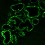 Immunofluorescence - Anti-Estrogen Receptor alpha Antibody [ER506] (CF®488A) (A352597) - Antibodies.com