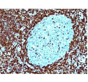 Immunohistochemistry (formalin-fixed, paraffin-embedded) - Anti-Bcl-2 Antibody [124] (CF®568) (A352611) - Antibodies.com