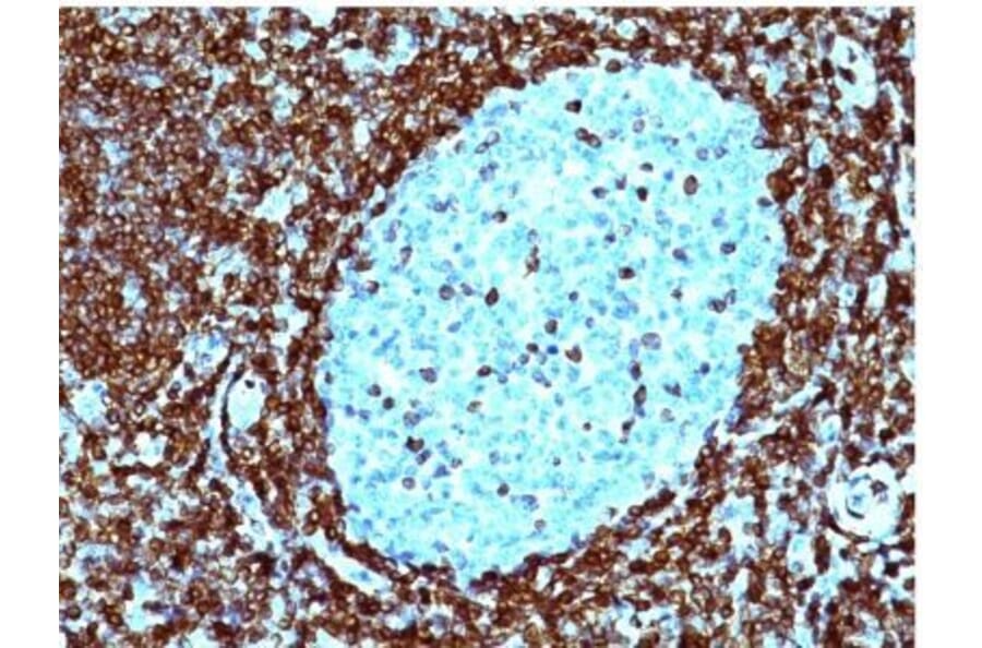 Immunohistochemistry (formalin-fixed, paraffin-embedded) - Anti-Bcl-2 Antibody [124] (CF®488A) (A352613) - Antibodies.com