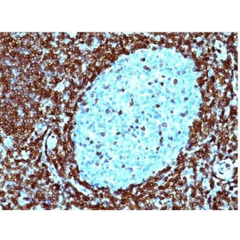 Immunohistochemistry (formalin-fixed, paraffin-embedded) - Anti-Bcl-2 Antibody [124] (CF®488A) (A352613) - Antibodies.com