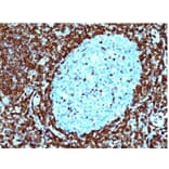 Immunohistochemistry (formalin-fixed, paraffin-embedded) - Anti-Bcl-2 Antibody [124] (CF®488A) (A352613) - Antibodies.com