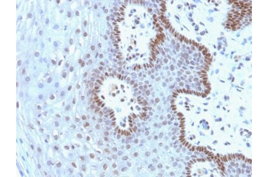 Immunohistochemistry (formalin-fixed, paraffin-embedded) - Anti-c-Myc Antibody [9E10.3] (CF®405S) (A352619) - Antibodies.com