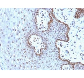Immunohistochemistry (formalin-fixed, paraffin-embedded) - Anti-c-Myc Antibody [9E10.3] (CF®647) (A352622) - Antibodies.com
