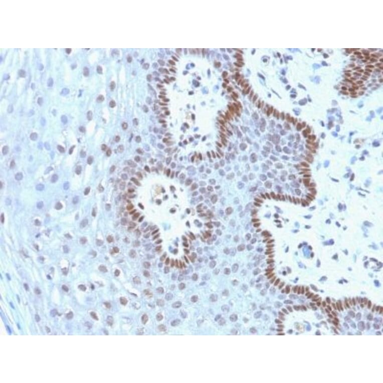 Immunohistochemistry (formalin-fixed, paraffin-embedded) - Anti-c-Myc Antibody [9E10.3] (CF®647) (A352622) - Antibodies.com