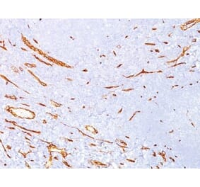 Immunohistochemistry (formalin-fixed, paraffin-embedded) - Anti-CD34 Antibody [QBEnd/10] (CF®640R) (A352631) - Antibodies.com
