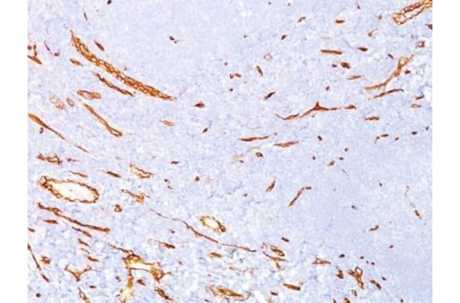 Immunohistochemistry (formalin-fixed, paraffin-embedded) - Anti-CD34 Antibody [QBEnd/10] (CF®640R) (A352631) - Antibodies.com
