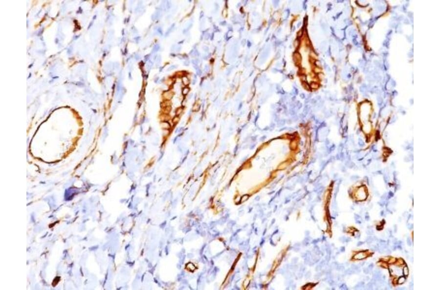 Immunohistochemistry (formalin-fixed, paraffin-embedded) - Anti-CD34 Antibody [QBEnd/10] (CF®640R) (A352631) - Antibodies.com