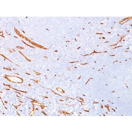 Immunohistochemistry (formalin-fixed, paraffin-embedded) - Anti-CD34 Antibody [QBEnd/10] (CF®647) (A352632) - Antibodies.com