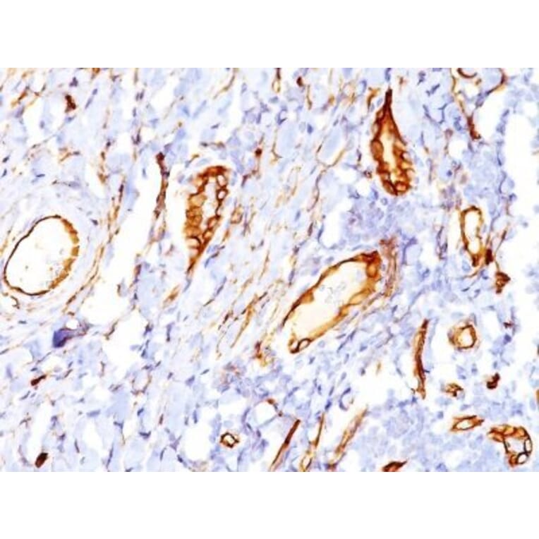 Immunohistochemistry (formalin-fixed, paraffin-embedded) - Anti-CD34 Antibody [QBEnd/10] (CF®660R) (A352633) - Antibodies.com