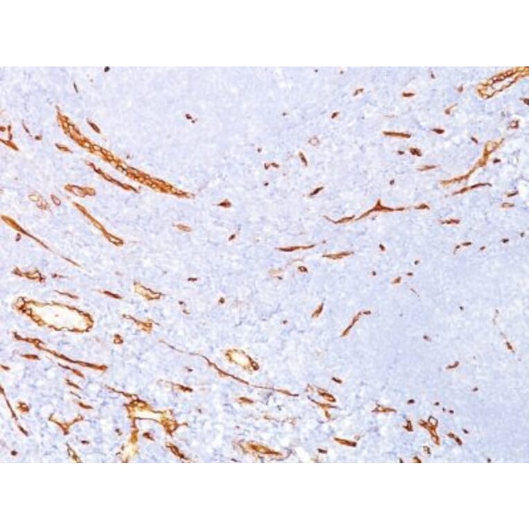 Immunohistochemistry (formalin-fixed, paraffin-embedded) - Anti-CD34 Antibody [QBEnd/10] (CF®740) (A352635) - Antibodies.com