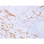 Immunohistochemistry (formalin-fixed, paraffin-embedded) - Anti-CD34 Antibody [QBEnd/10] (CF®594) (A352637) - Antibodies.com