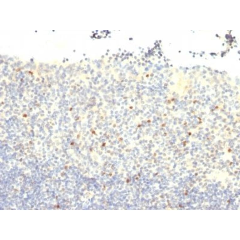 Immunohistochemistry (formalin-fixed, paraffin-embedded) - Anti-FOXP3 Antibody [3G3] (CF®405S) (A352655) - Antibodies.com