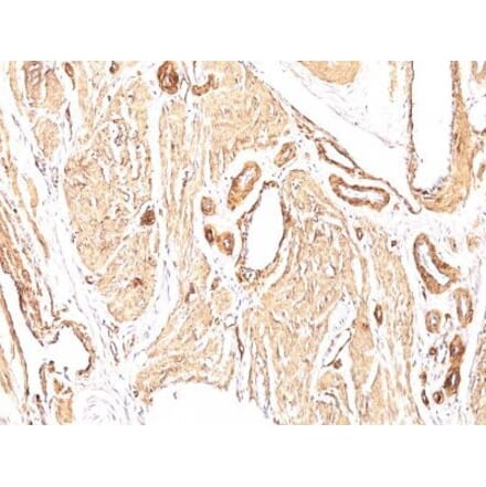 Immunohistochemistry (formalin-fixed, paraffin-embedded) - Anti-alpha Smooth Muscle Actin Antibody [1A4] (CF®640R) (A352697) - Antibodies.com