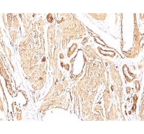 Immunohistochemistry (formalin-fixed, paraffin-embedded) - Anti-alpha Smooth Muscle Actin Antibody [1A4] (CF®568) (A352699) - Antibodies.com