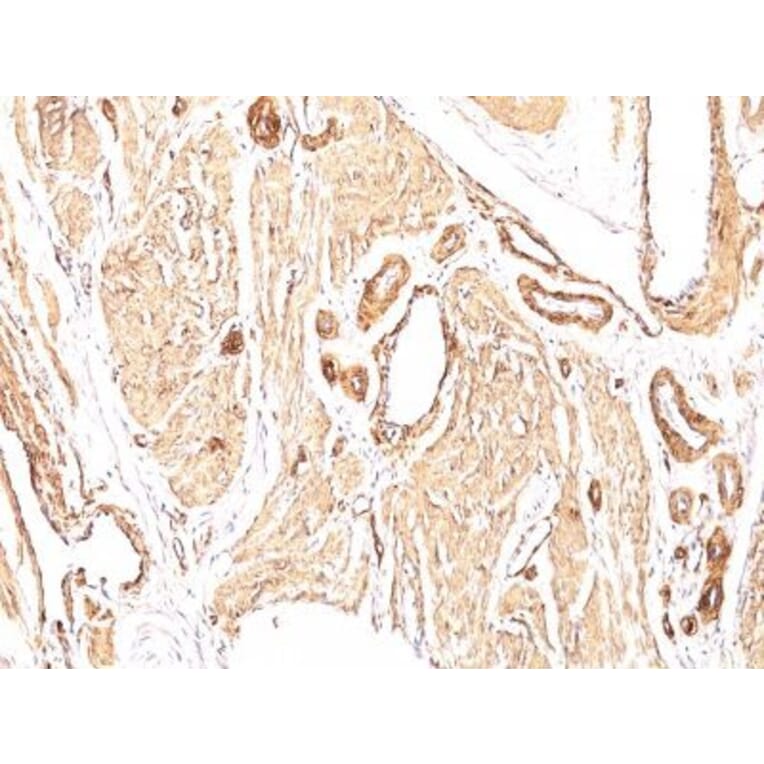 Immunohistochemistry (formalin-fixed, paraffin-embedded) - Anti-alpha Smooth Muscle Actin Antibody [1A4] (CF®740) (A352700) - Antibodies.com