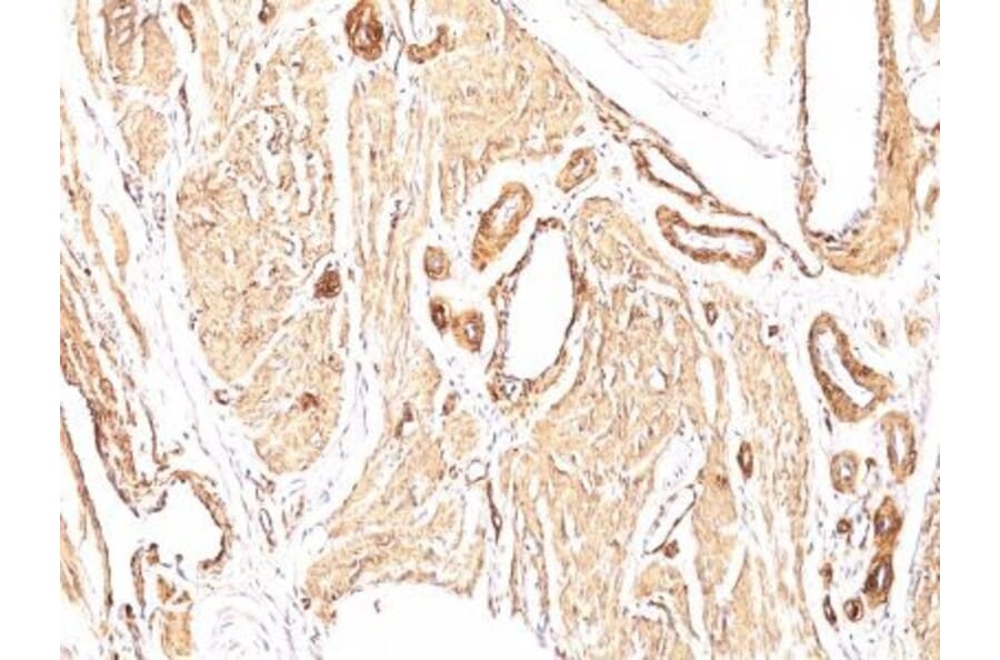 Immunohistochemistry (formalin-fixed, paraffin-embedded) - Anti-alpha Smooth Muscle Actin Antibody [1A4] (CF®488A) (A352702) - Antibodies.com