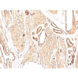 Immunohistochemistry (formalin-fixed, paraffin-embedded) - Anti-alpha Smooth Muscle Actin Antibody [1A4] (Biotin) (A352704) - Antibodies.com