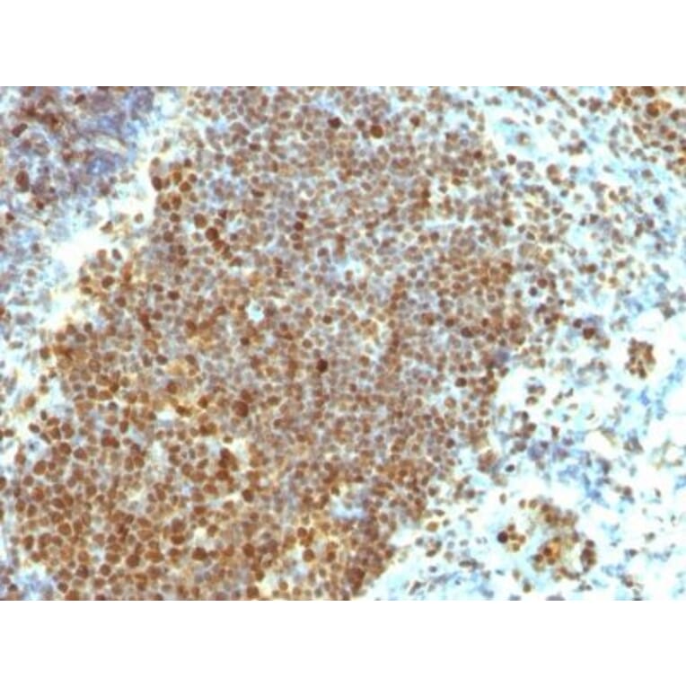 Immunohistochemistry (formalin-fixed, paraffin-embedded) - Anti-PCNA Antibody [PCNA/694] (CF®640R) (A352706) - Antibodies.com