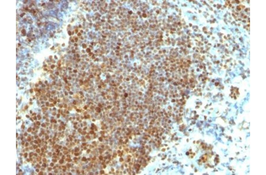 Immunohistochemistry (formalin-fixed, paraffin-embedded) - Anti-PCNA Antibody [PCNA/694] (Biotin) (A352712) - Antibodies.com