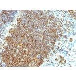 Immunohistochemistry (formalin-fixed, paraffin-embedded) - Anti-PCNA Antibody [PCNA/694] (Biotin) (A352712) - Antibodies.com