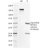 SDS-PAGE - Anti-ErbB2 Antibody [HRB2/718] (CF®405S) (A352730) - Antibodies.com