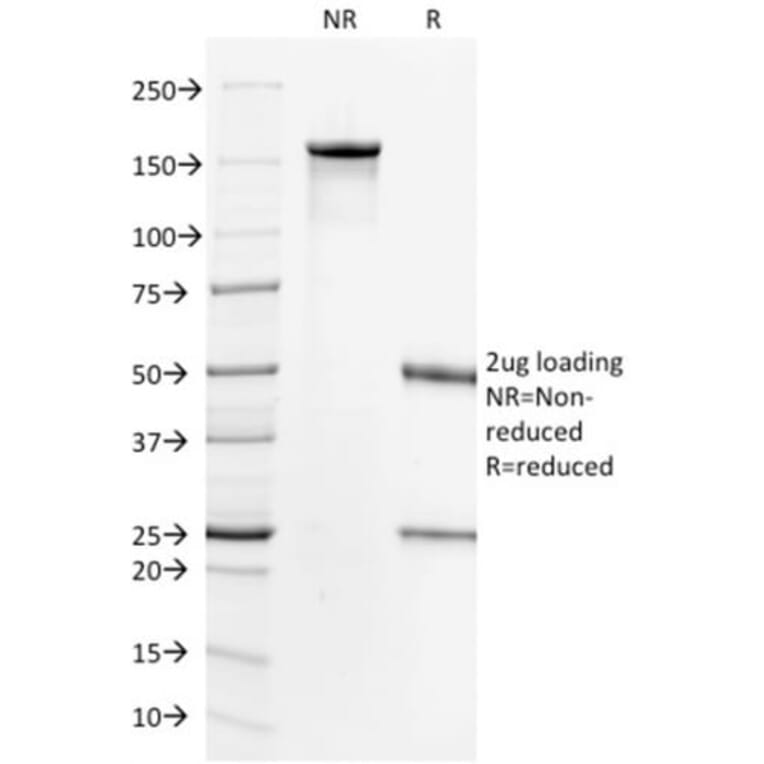 SDS-PAGE - Anti-ErbB2 Antibody [HRB2/718] (CF®640R) (A352731) - Antibodies.com