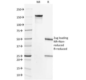 SDS-PAGE - Anti-ErbB2 Antibody [HRB2/718] (CF®740) (A352734) - Antibodies.com