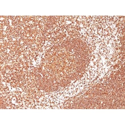 Immunohistochemistry (formalin-fixed, paraffin-embedded) - Anti-CD45 Antibody [2B11 + PD7/26] (CF®640R) (A352789) - Antibodies.com