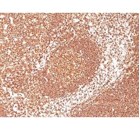 Immunohistochemistry (formalin-fixed, paraffin-embedded) - Anti-CD45 Antibody [2B11 + PD7/26] (CF®740) (A352793) - Antibodies.com