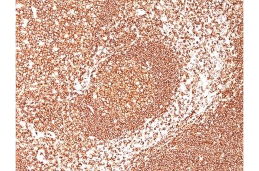 Immunohistochemistry (formalin-fixed, paraffin-embedded) - Anti-CD45 Antibody [2B11 + PD7/26] (CF®488A) (A352794) - Antibodies.com